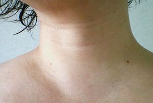 10月キャンペーン