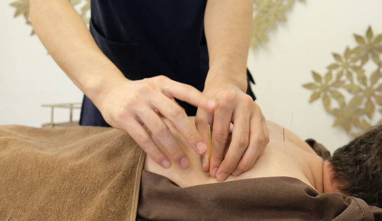 冷えは万病のもと！はり・きゅうで体ぽかぽか免疫力アップ